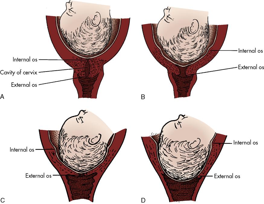 6-process-of-normal-labor-nurse-key