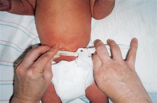 10. Nursing Care of the Newborn | Nurse Key