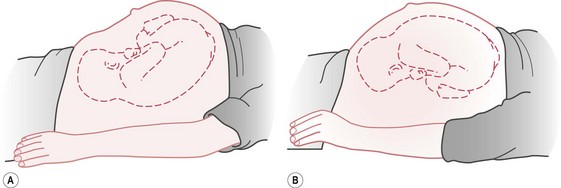 abdominal contour definition