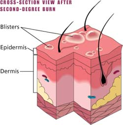 Integumentary care | Nurse Key