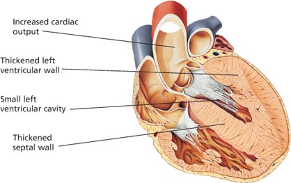 Cardiovascular care | Nurse Key