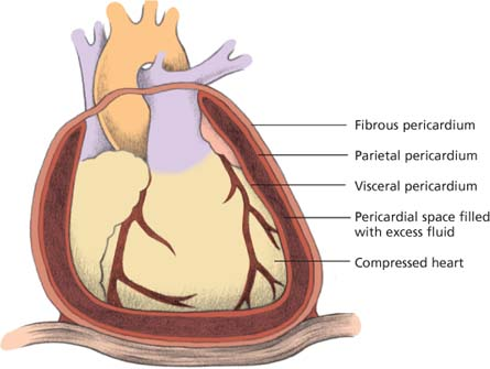 Cardiovascular care | Nurse Key