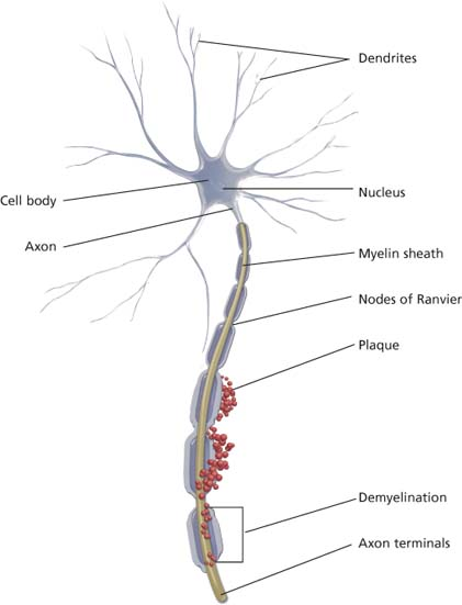 Neurologic care | Nurse Key