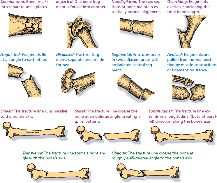 Musculoskeletal Care | Nurse Key