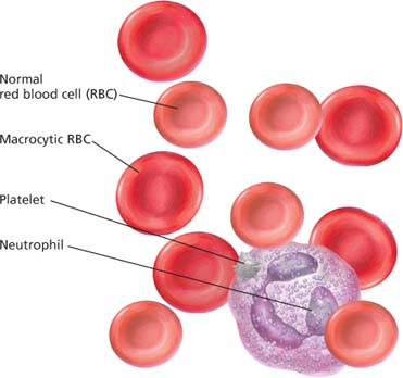 Hematologic and Immunologic care | Nurse Key