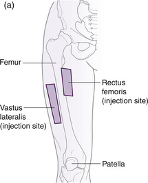 rectus femoris injection site