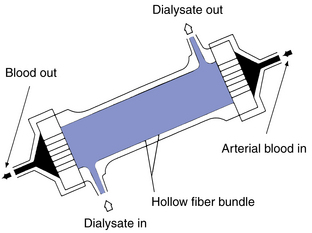 Advantages of hollow fiber dialyzers