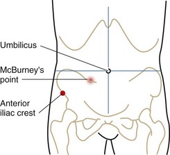 Care Of Patients With Inflammatory Intestinal Disorders Nurse Key Care Of Patients With Inflammatory Intestinal Disorders Nurse Key