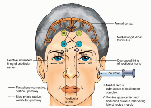 Headaches | Nurse Key