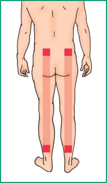 Position of transcutaneous electrical nerve stimulation (TENS)