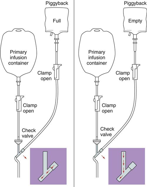 Piggyback system for intravenous therapy used in the hospital of the