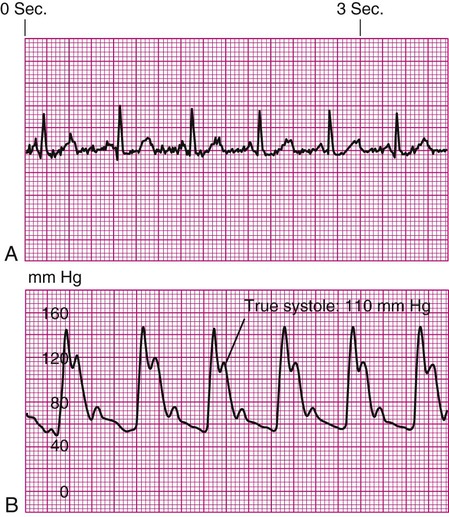 Arterial line dynamic response testing