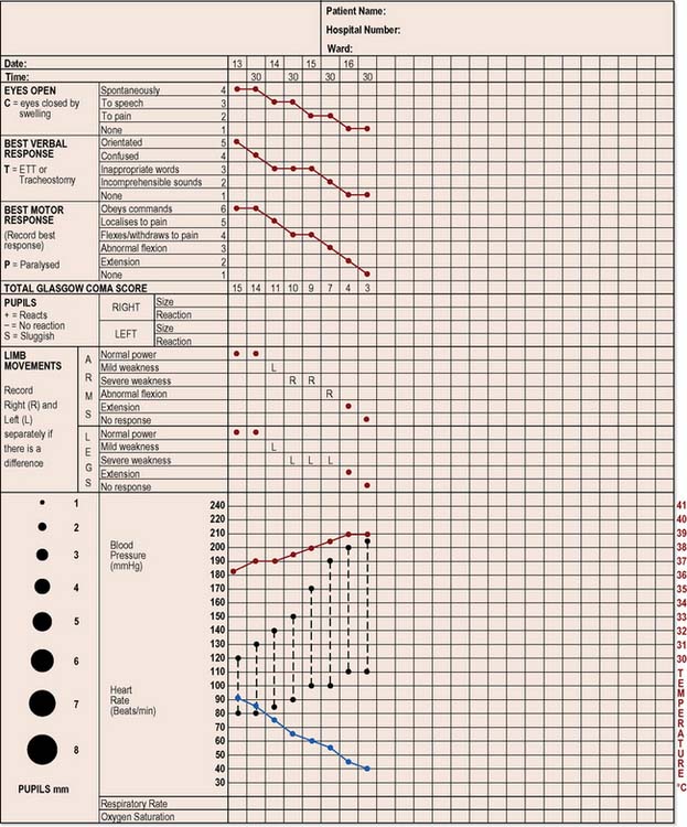 Neurological Assessment Chart