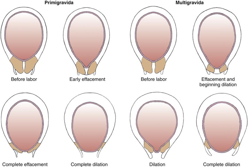 Vital Stages Of Labor: What Happens In Them And What To Do