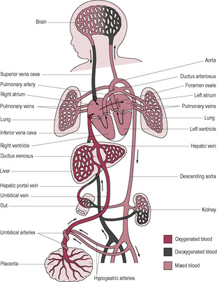 The transition to neonatal life