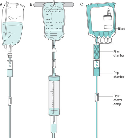 intravenous therapy equipment