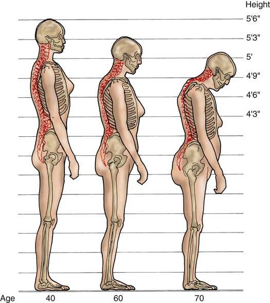 Physiological Changes Nurse Key