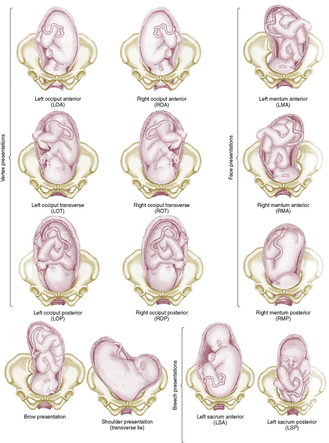 what is normal fetal presentation at delivery