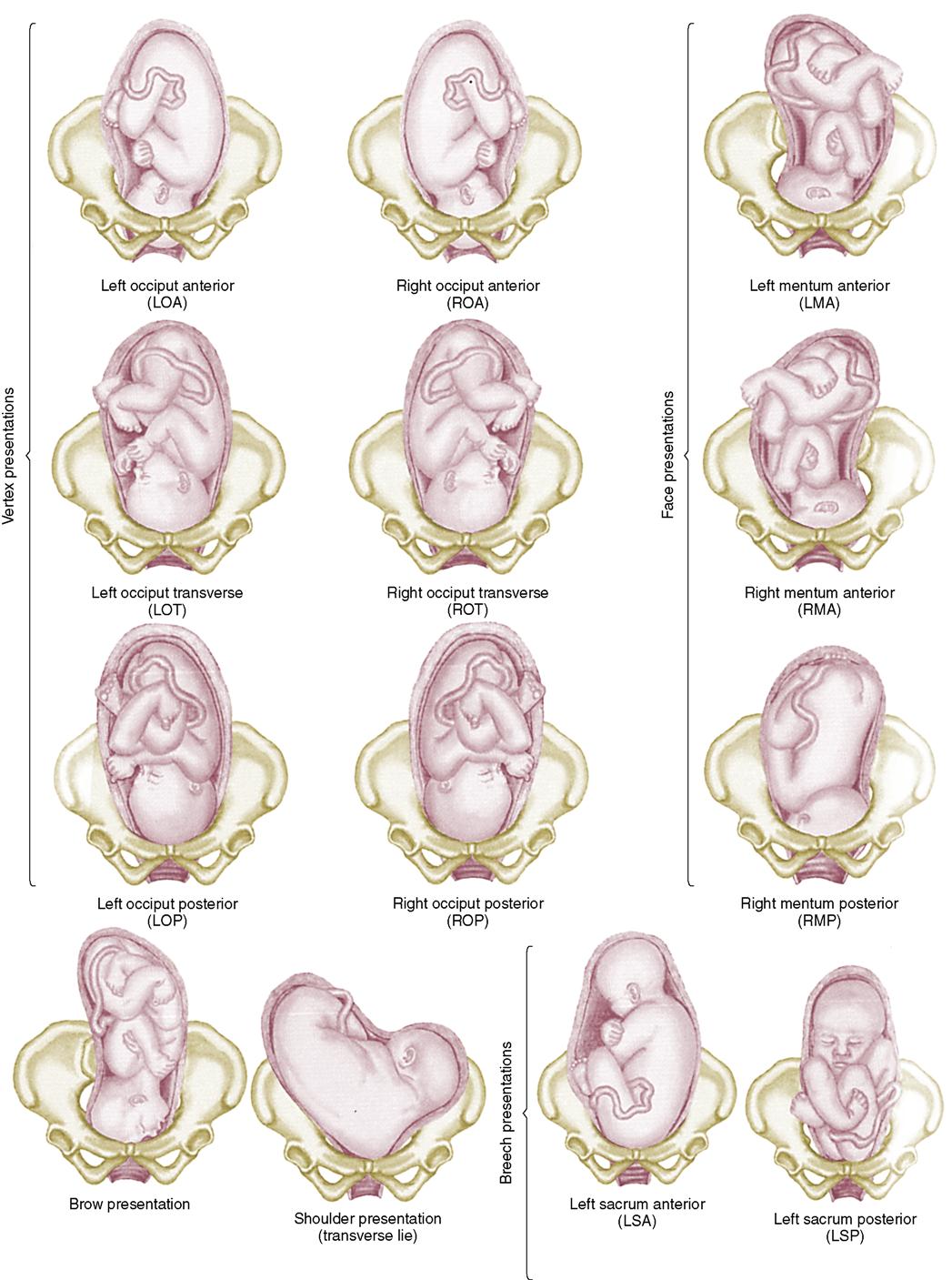 6 Process Of Normal Labor Nurse Key 6 Process Of Normal Labor Nurse Key