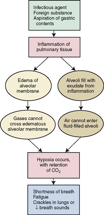 pneumonia-concept-map-nursing