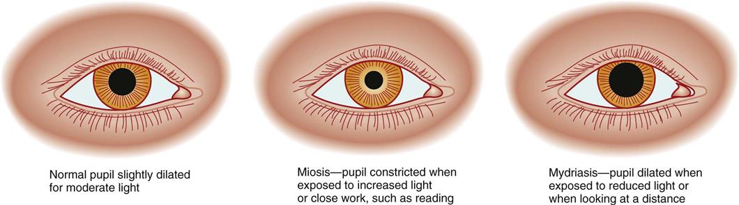 pupillary constriction