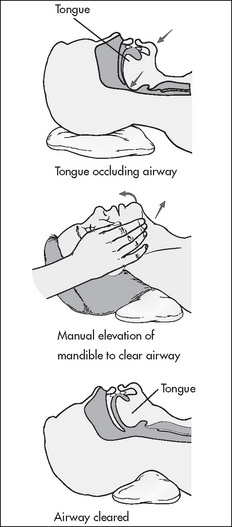 Postanaesthesia recovery unit | Nurse Key