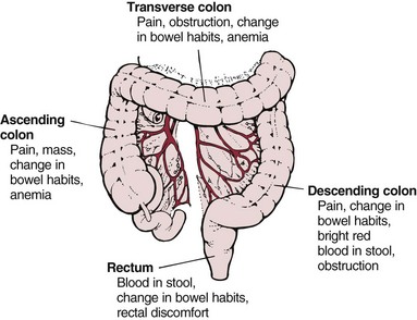 Nursing Care Of Clients With Gastrointestinal System Disorders | Nurse Key