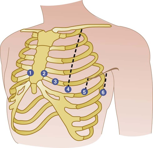 Cardiopulmonary Procedures | Nurse Key