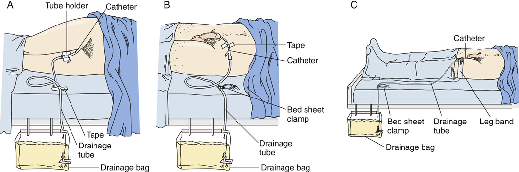 Pora Tube