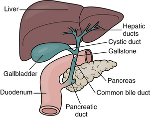 Digestive and Endocrine Disorders | Nurse Key