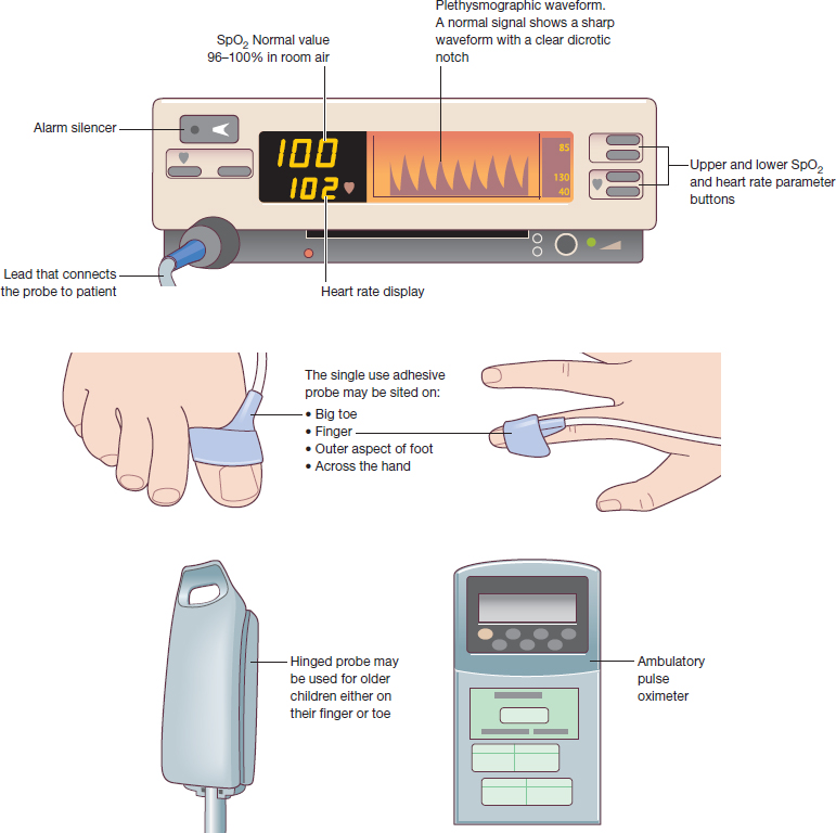 Pulse Oximetry | Nurse Key