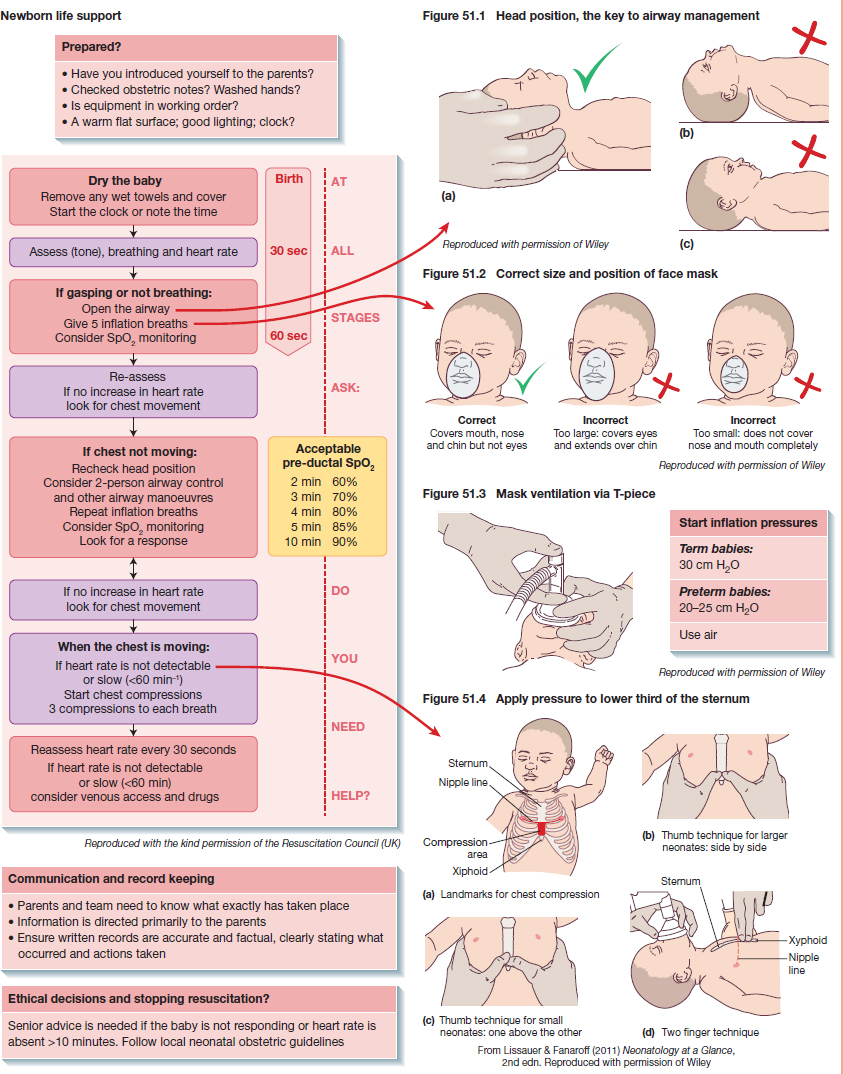 Neonatal Resuscitation Program Reference Chart Nrp