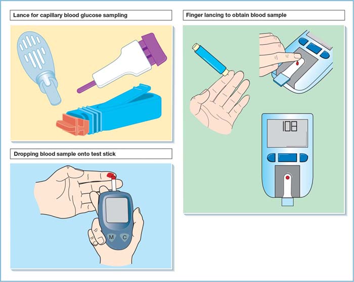 Capillary Blood Sugar