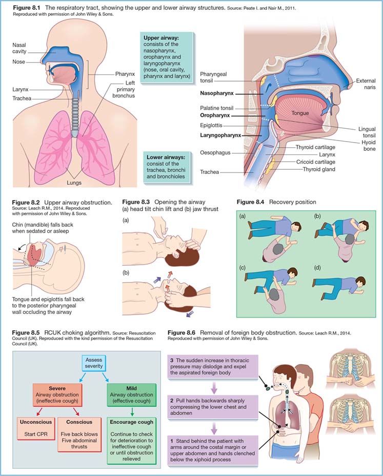 Advanced Airway Management | Nurse Key