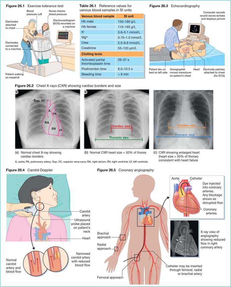 Cardiac Investigations | Nurse Key