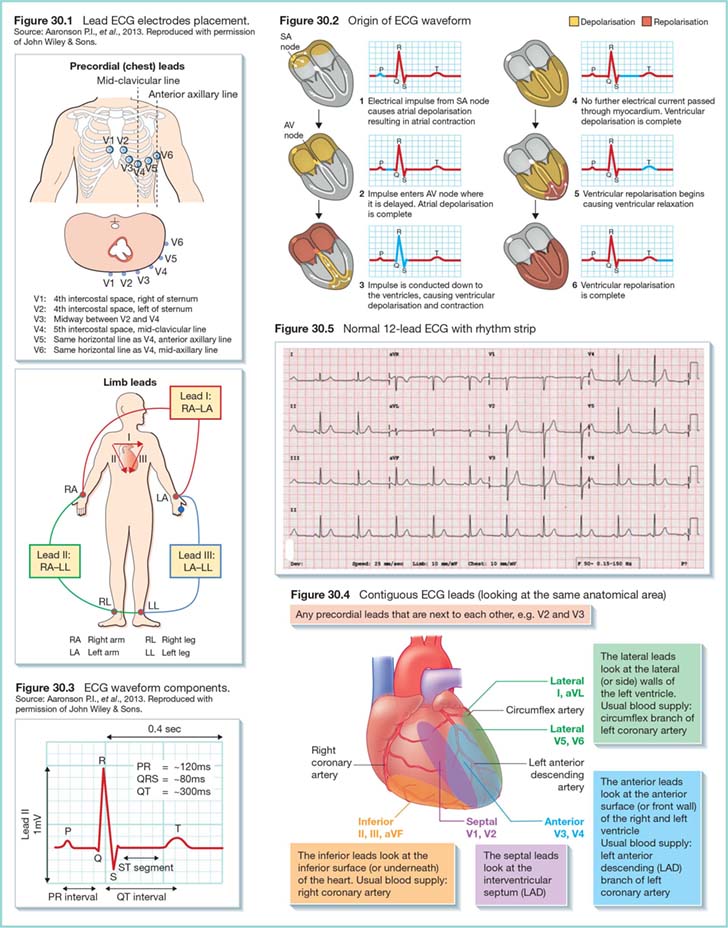 12 Lead ECG Reference Chart | Ubicaciondepersonas.cdmx.gob.mx