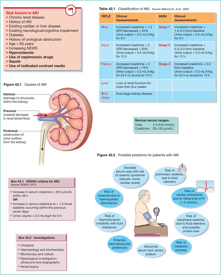 Acute Kidney Injury | Nurse Key