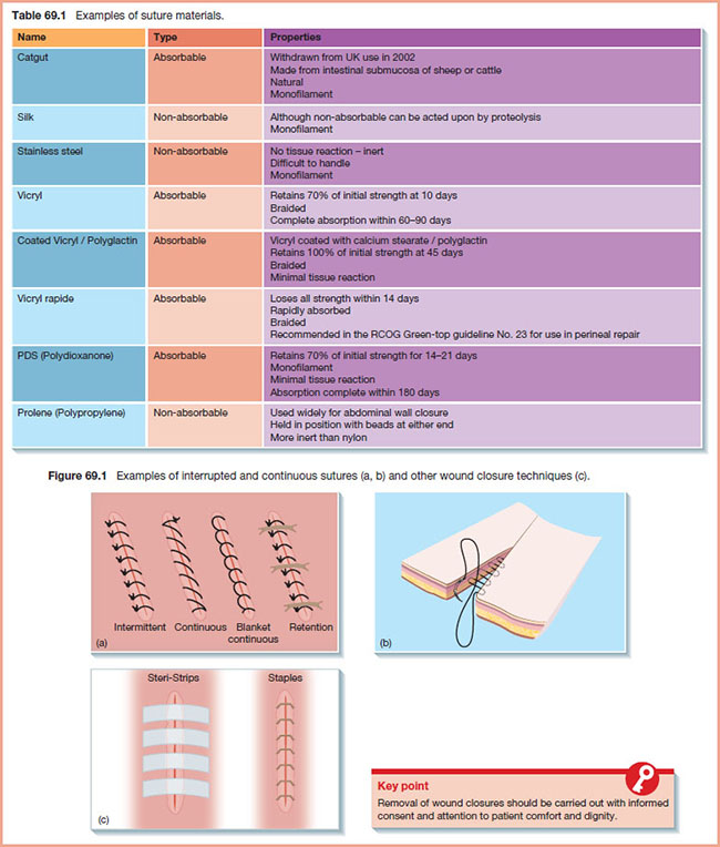 Types Of Wound Closure - Catalog Library